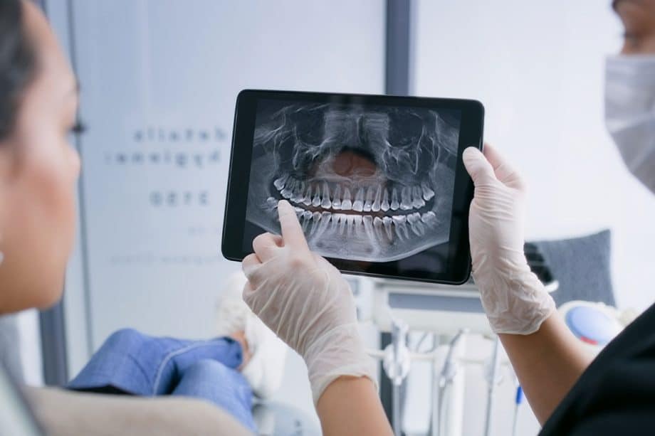 At What Age Should a Child Get Their First Dental X-Ray?